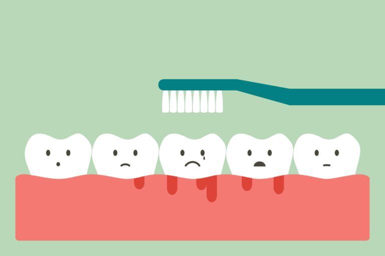 Cartoon of sad teeth sitting on gums with gingivitis