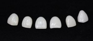 A row of porcelain veneers on a black background