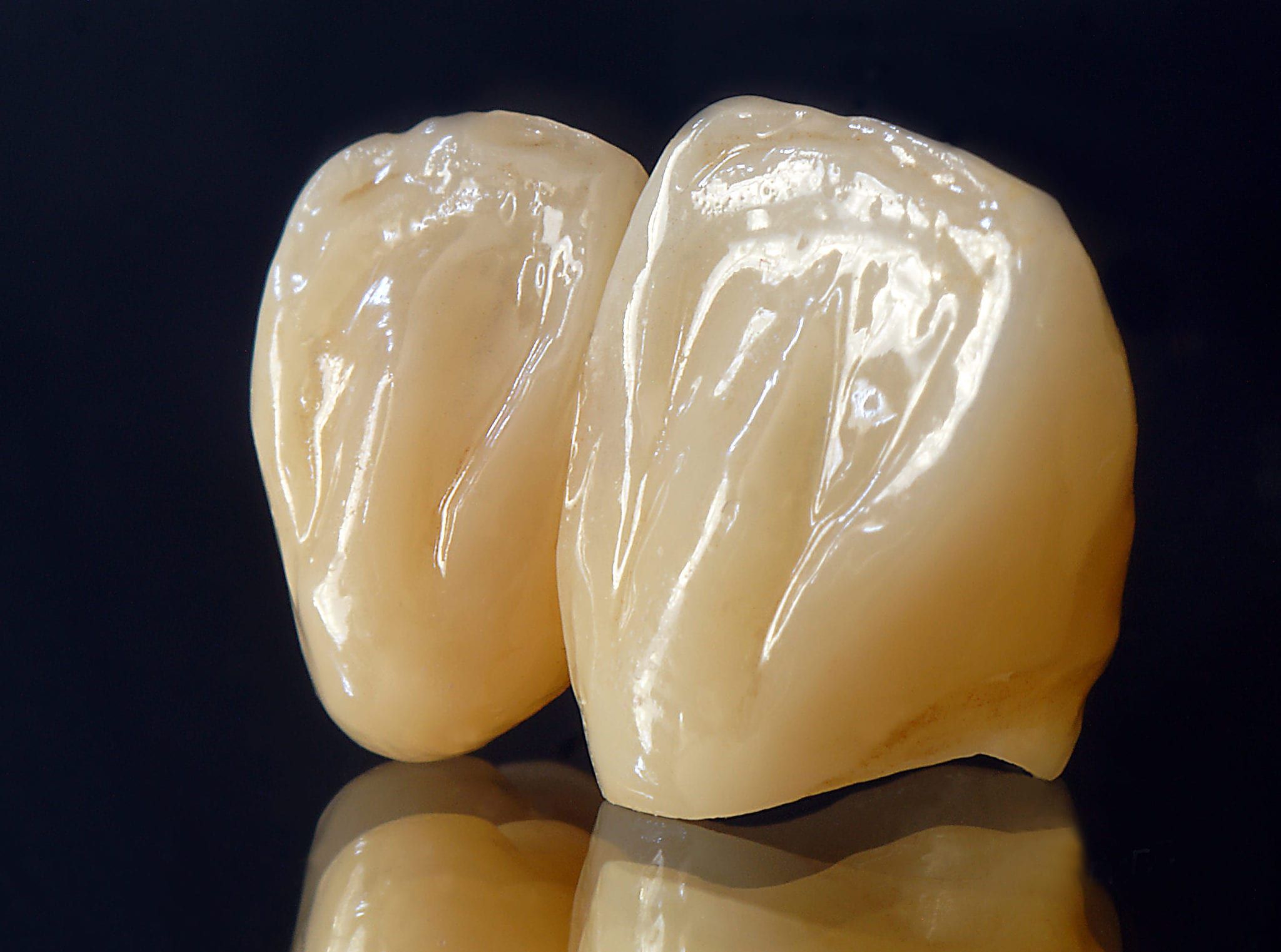 What Is A Zirconia Crown? Heritage Park Dental Dentist in Palo Alto